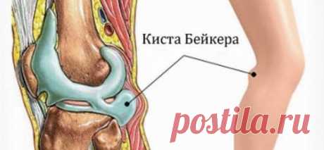 Причины, почему тянет ногу под коленом сзади