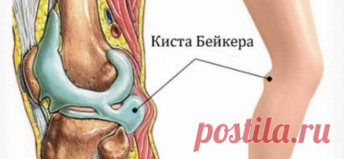 Причины, почему тянет ногу под коленом сзади