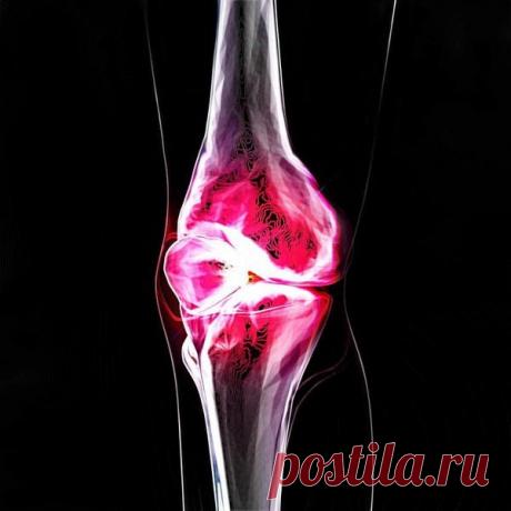 Бесполезные операции в ортопедии | MyFitnessLife | Яндекс Дзен