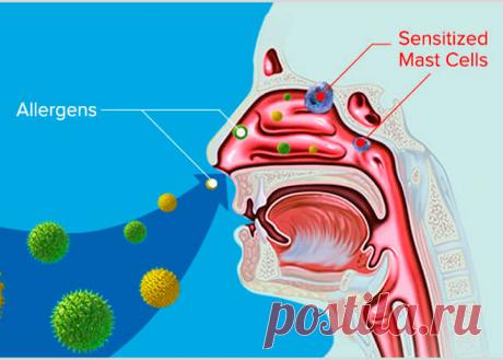 Болезнь из детства. Аллергия Если не брать во внимание официальные методы лечения, то заболевание ребенка может поведать родителям об очень многом. Какие факторы способствуют возникновению аллергии, можно ли ее вылечить или просто перерасти?