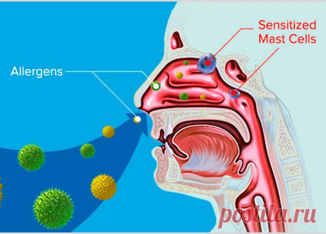 Болезнь из детства. Аллергия Если не брать во внимание официальные методы лечения, то заболевание ребенка может поведать родителям об очень многом. Какие факторы способствуют возникновению аллергии, можно ли ее вылечить или просто перерасти?