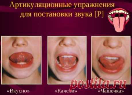 Постановка звука Р поэтапно ребенку. Занятия, конспект для логопеда, родителей, видео уроки, последовательность упражнения с картинками. Артикуляционная гимнастика