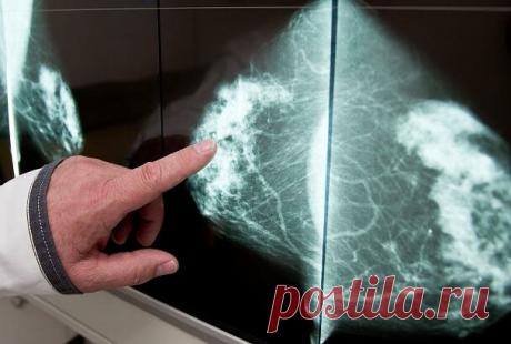 Названы три смертельные болезни, основной симптом которых – боль в спине