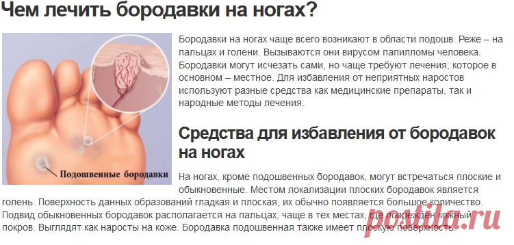 Аптечные средства от бородавок на ногах

Средства от бородавок на ногах – характеристика лечебных средств