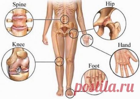 При отложении солей в суставах - Блог Марина на 24open.ru