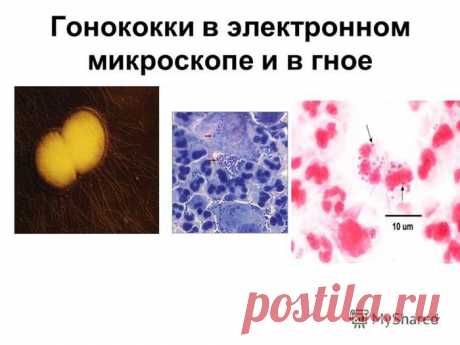 Лечим дома:гонококки