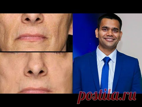 Возрастная Кожа : Как Ухаживать ? | ПРОСТАЯ СЫВОРОТКА ОСТАНОВИТ СТАРЕНИЕ, ОМОЛОДИТ и ПОДТЯНЕТ КОЖУ