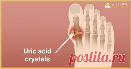 Уменьшите уровень мочевой кислоты с помощью 7 лучших домашних средств - Упражнения и похудение Вы будете удивлены результатом! Окружающая среда и наследственность являются двумя ведущими факторами, которые отвечают за такие проблемы. Хроническая боль, гипертония и ожирение — это некоторые общие симптомы мочевой кислоты, которые возникают из-за избыточного количества мочевой кислоты. Но вам не нужно беспокоиться об этом. Вот некоторые естественные методы, которые уменьшают ...