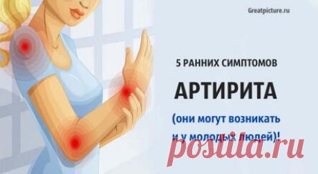 5 ранних симптомов артрита они могут возникать и у молодых людей!