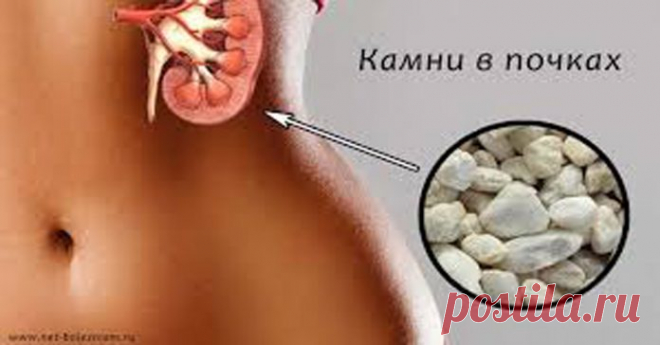 С этим лекарством камни в почках и желчном «растают»! Врачи рекомендуют!