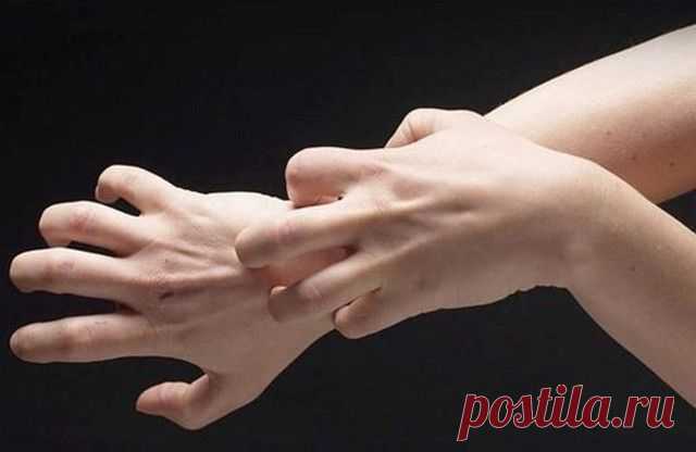 Укусы комаров: 17 домашних средств для снятия зуда