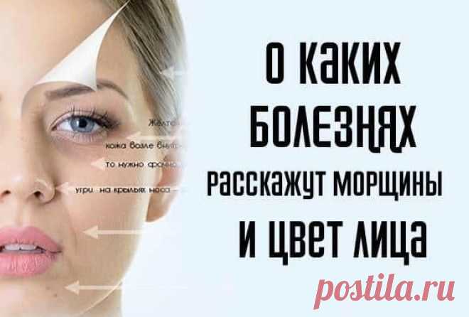 О каких болезнях расскажут морщины и цвет лица 

Быстро увядающая, висящая кожа на скулах и щеках предупреждает, что возможны заболевания мочевого пузыря. Отекающий подбородок и шея под нижней челюстью – проблемы здоровья, связанные с плохой работ…
