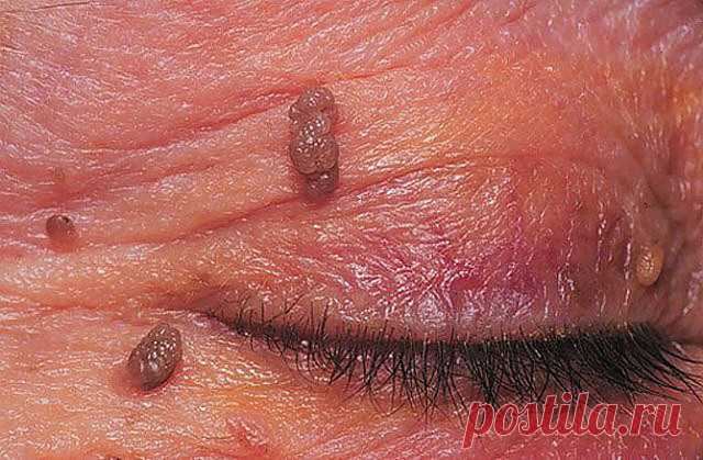 (20) Однокласники