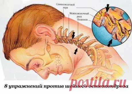 8 УПРАЖНЕНИЙ ОТ ШЕЙНОГО ОСТЕОХОНДРОЗА