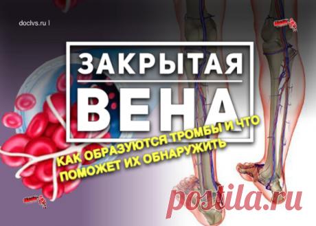 Если вена на голени вдруг стала плотной и болезненной или сильно опухла нога, необходимо срочно вызвать врача. Подобные симптомы могут указывать на тромбофлебит.