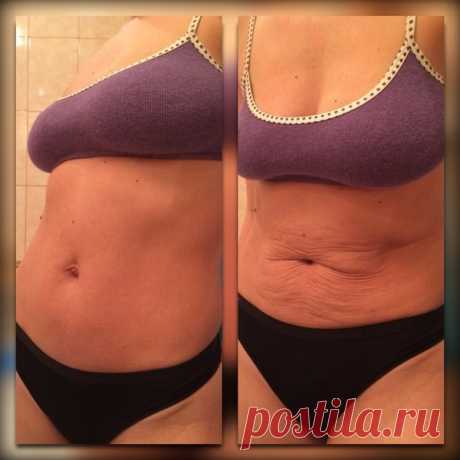 Благодаря аптечному средству за 200 руб: Я избавилась от жирного живота за 4 недели! | Домашняя Красота | Яндекс Дзен