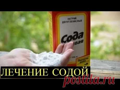 Копеечная пищевая Сода лечит Лучше лекарств! 18 Рецептов лечения Содой! - YouTube