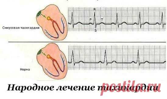(1) Одноклассники