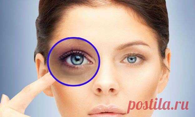 Как ухаживать за кожей вокруг глаз: 4 подсказки, для уменьшения отёков и темных кругов - Дзен дневник