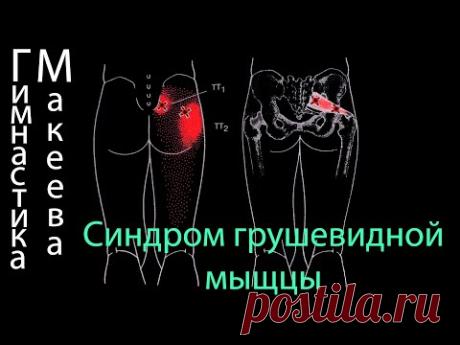 Лучшее упражнение для лечения грушевидной мышцы.