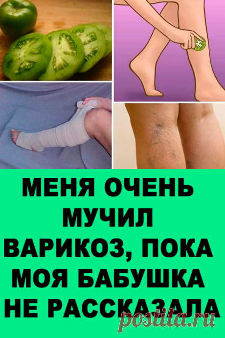 Меня очень мучил варикоз, пока моя бабушка не рассказала мне об этом средстве… Теперь мои ножки прекрасно выглядят и не болят .. — Женские Советы