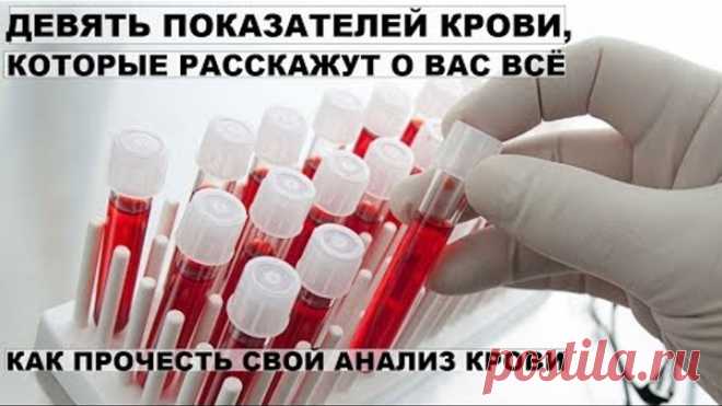 КАК САМОСТОЯТЕЛЬНО ПРОЧЕСТЬ АНАЛИЗ КРОВИ. ОБЩИЙ И БИОХИМИЧЕСКИЙ АНАЛИЗ КРОВИ