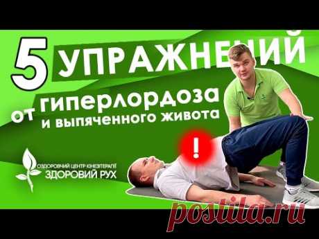 5 упражнений при гиперлордозе, как убрать выпячивание живота