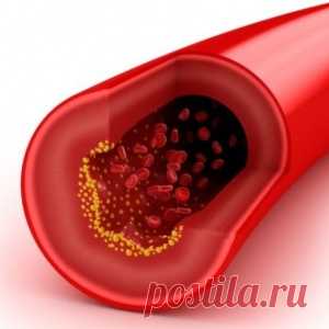 Уникальные методики очищения сосудов мозга, о которых умалчивают врачи