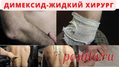 Что творит димексид?.Если не знали, то повторите! Боль исчезнет !. ЖИДКИЙ ХИРУРГ.
