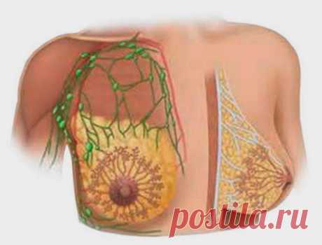 Мастит и диатез | Друг пенсионера
Хочу написать про то, с какими еще неприятными болезнями я сталкивалась и как справлялась с ними.