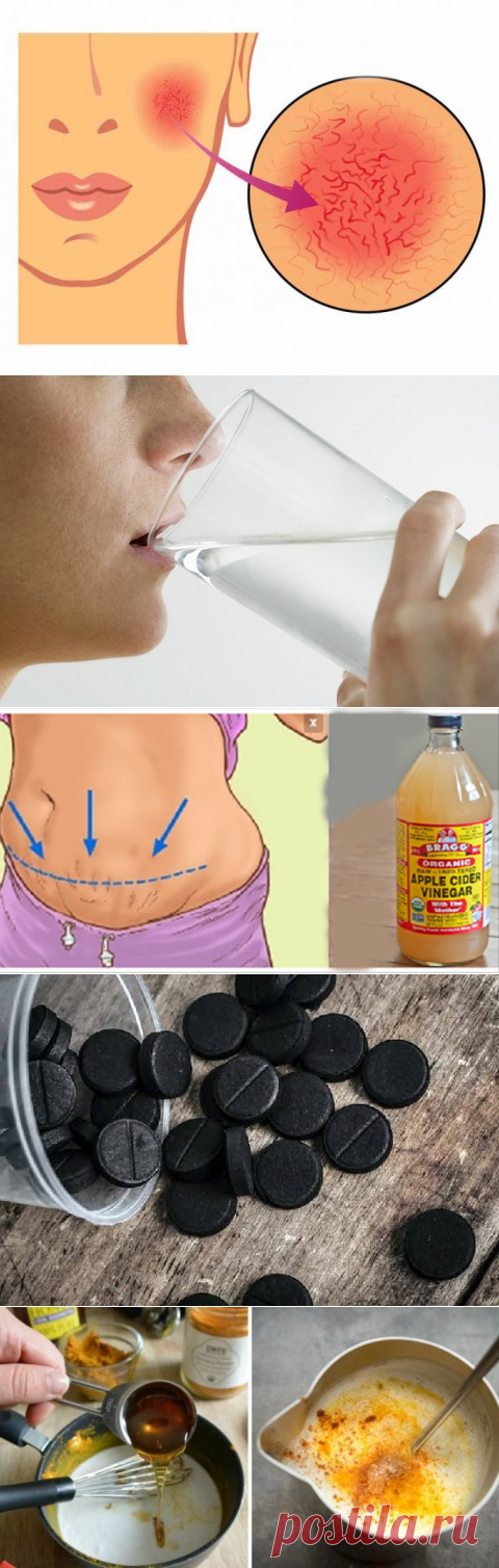 Безопасные и эффективные домашние средства для разрушенных кровеносных сосудов