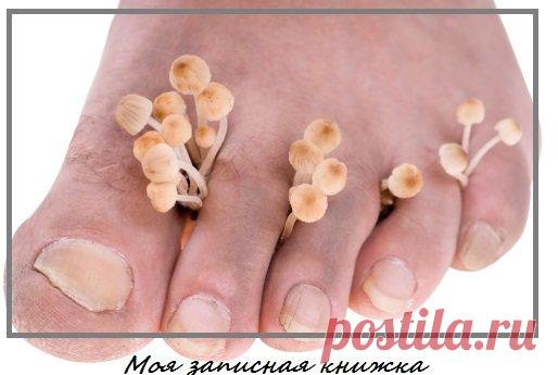 Как копеечное сильное средство поможет навсегда избавиться от грибка ногтей | моя записная книжка | Яндекс Дзен