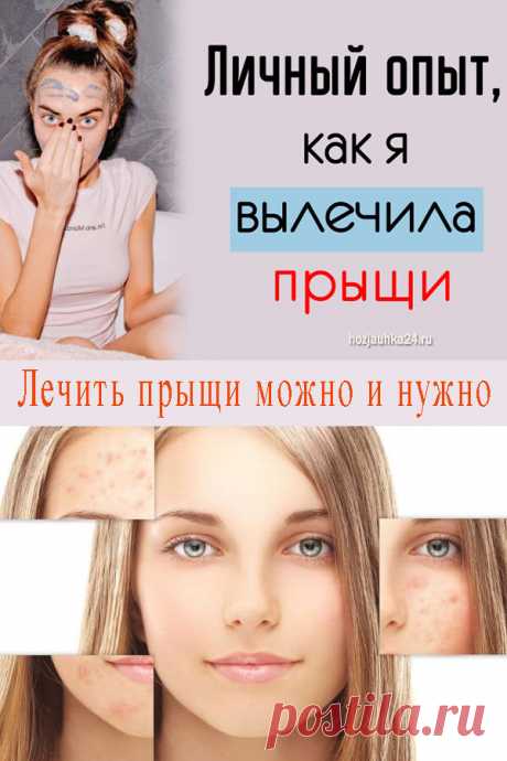 Личный опыт, как я вылечила прыщи ⋆ Хозяюшка