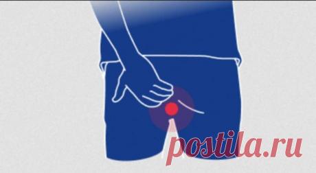 Как лечить геморрой, когда нет возможности сходить к проктологу | Детралекс | Пульс Mail.ru Для того, чтобы вылечить недуг, нужно понимать его природу. Геморрой связан с воспалительным процессом. Но не совсем обычным.