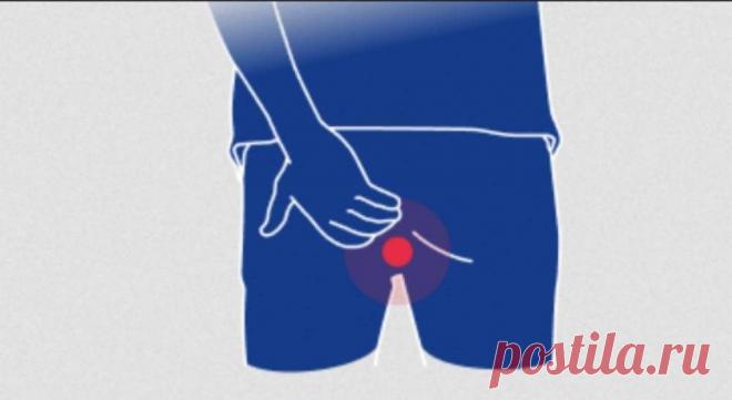 Как лечить геморрой, когда нет возможности сходить к проктологу | Детралекс | Пульс Mail.ru Для того, чтобы вылечить недуг, нужно понимать его природу. Геморрой связан с воспалительным процессом. Но не совсем обычным.