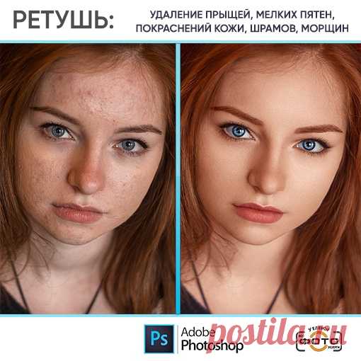 фотографии до и после обработки: 9 тыс изображений найдено в Яндекс Картинках