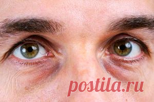 Как убрать мешки под глазами, то что скрывают врачи