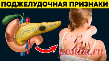 10 микросимптомов, которые часто пропускают при раке поджелудочной (чек-лист) | Главный Медицинский Канал | Медицина и Здоровье | Дзен