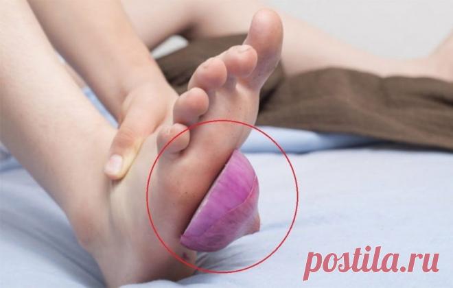 Почему следует класть лук в носки на ночь?