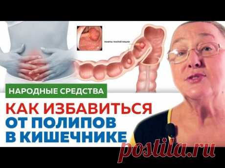 КАК ИЗБАВИТЬСЯ ОТ ПОЛИПОВ в кишечнике || народные средства