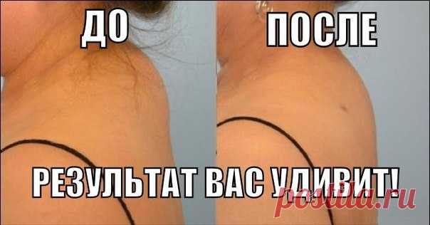 КАК ИЗБАВИТЬСЯ ОТ ХОЛКИ НА ШЕЕ 

У многих женщин после 35-40 лет в области седьмого шейного позвонка часто появляется 