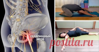 8 простых упражнений, которые помогут избавиться от защемления седалищного нерва! Наконец-то эта ноющая боль прошла!