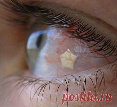 Шокирующий тренд: пирсинг глазных яблок