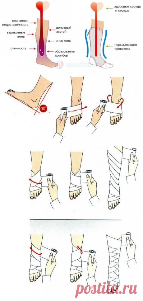 Зачем носить компрессионный трикотаж. — Всегда в форме!