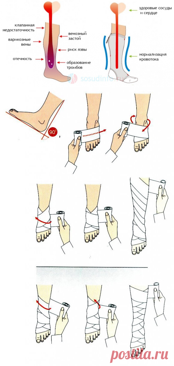 Зачем носить компрессионный трикотаж. — Всегда в форме!