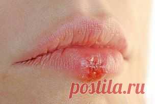 Людей ест не рак! - а грибы-слизевики.