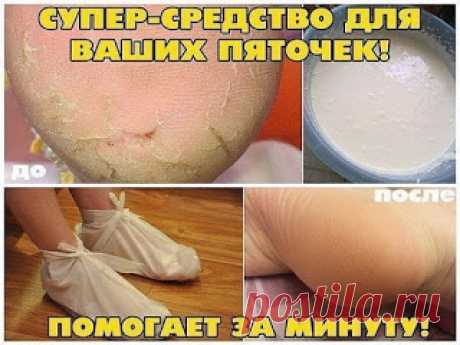 МАРИНОВАННЫЕ ПОМИДОРЫ ЗА 30 МИНУТ-ПРОСТО И БЕЗУМНО ВКУСНО!: ✔ ПОЛЕЗНЫЕ СОВЕТЫ : СОХРАНИТЕ, ЧТОБЫ НЕ ПОТЕРЯТЬ.