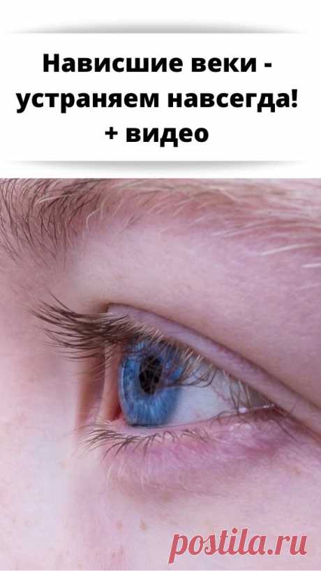 Нависшие веки - устраняем навсегда! + видео