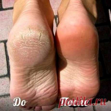 Новости - МирТесен