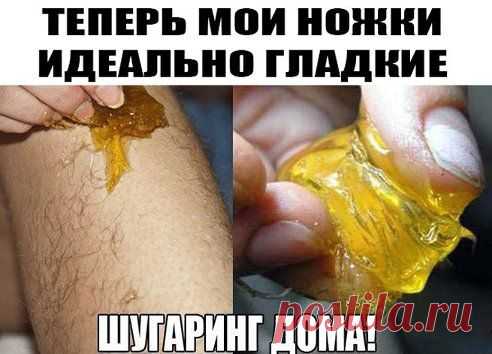 Эпиляция